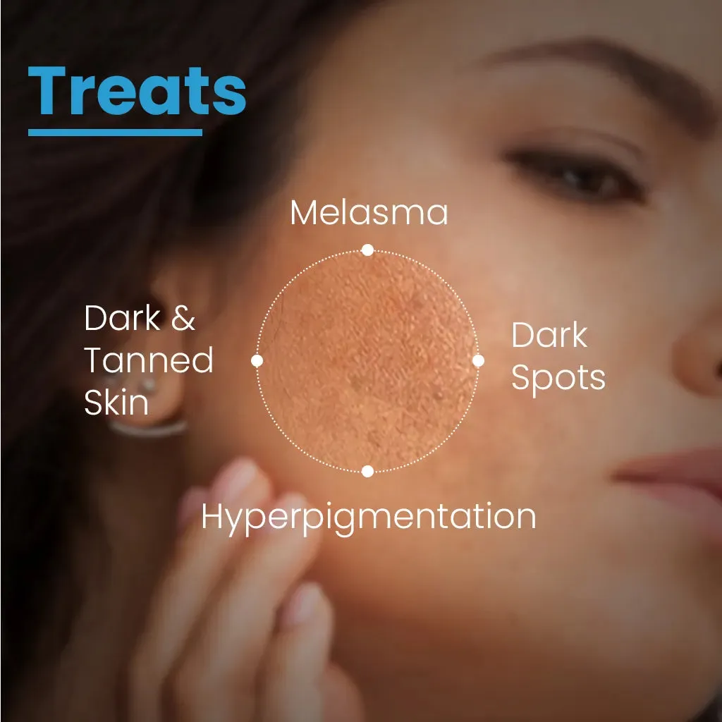 AHA Lightening Gel | Removes Dark spots, Dead cells, Melasma